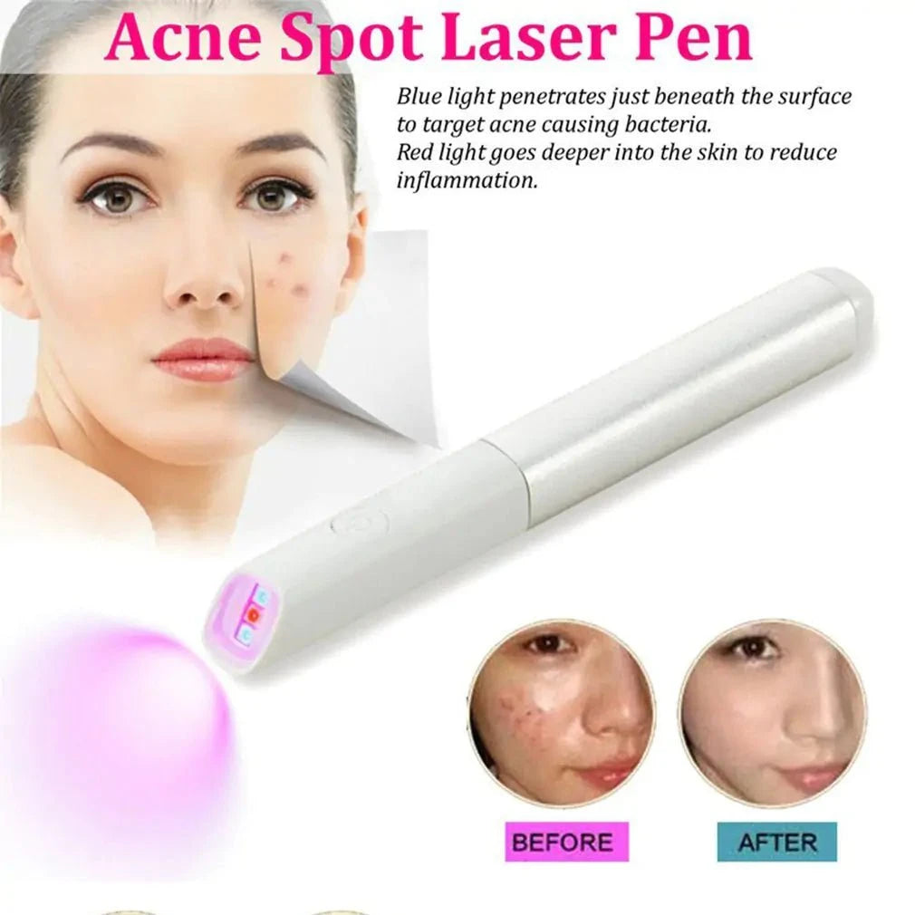 LumiHeal - Light Therapy Acne Spot Treatment, UV-Free, Clinically Proven, Gentle for Sensitive Skin
