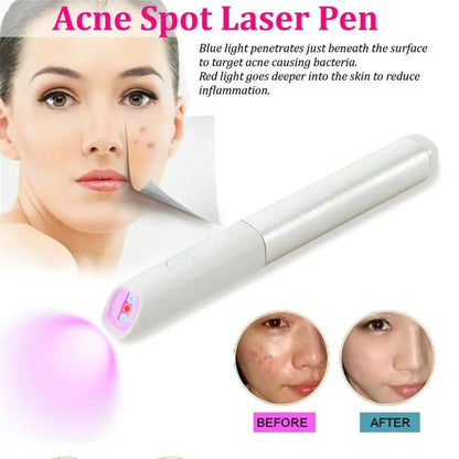 LumiHeal - Light Therapy Acne Spot Treatment, UV-Free, Clinically Proven, Gentle for Sensitive Skin